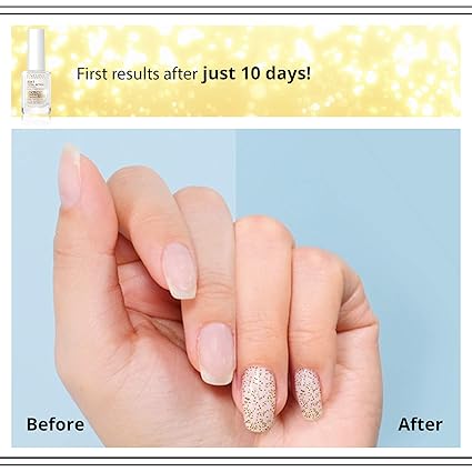 8-in-1 Nail Conditioner with Golden Particles (Original)