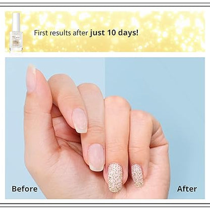 8-in-1 Nail Conditioner with Golden Particles (Original)